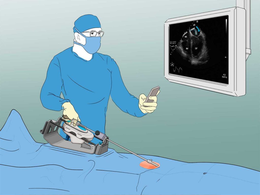illustration of surgeon using Moray Medical technology